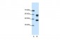 PSMC5 antibody - C-terminal region